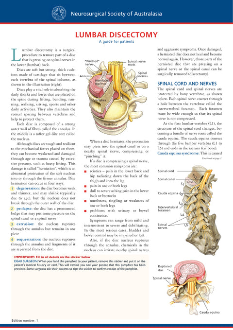 Lumbar Discectomy