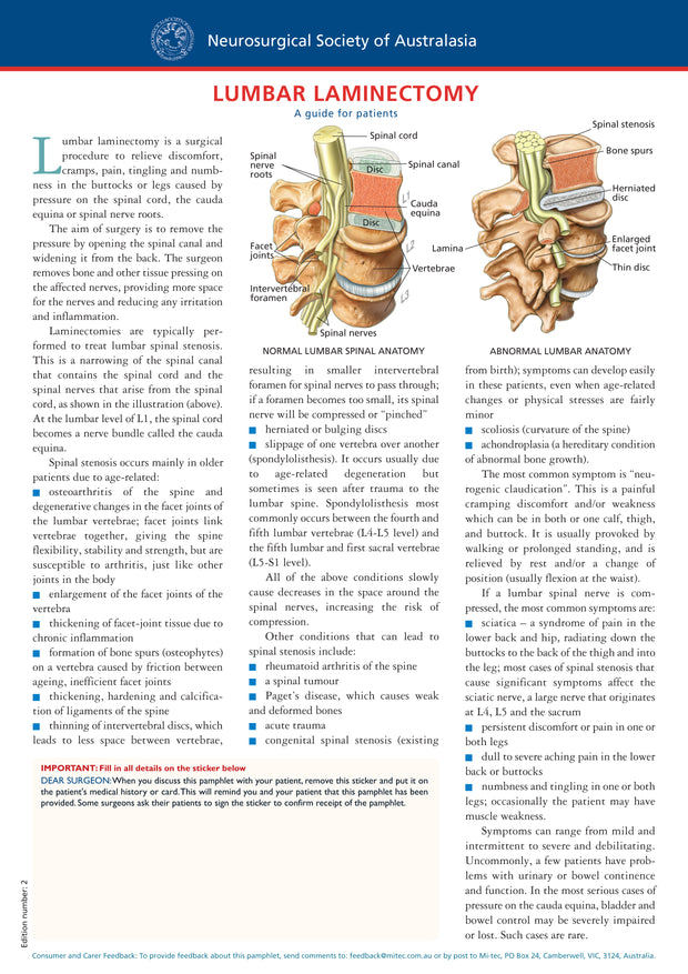 Lumbar Laminectomy