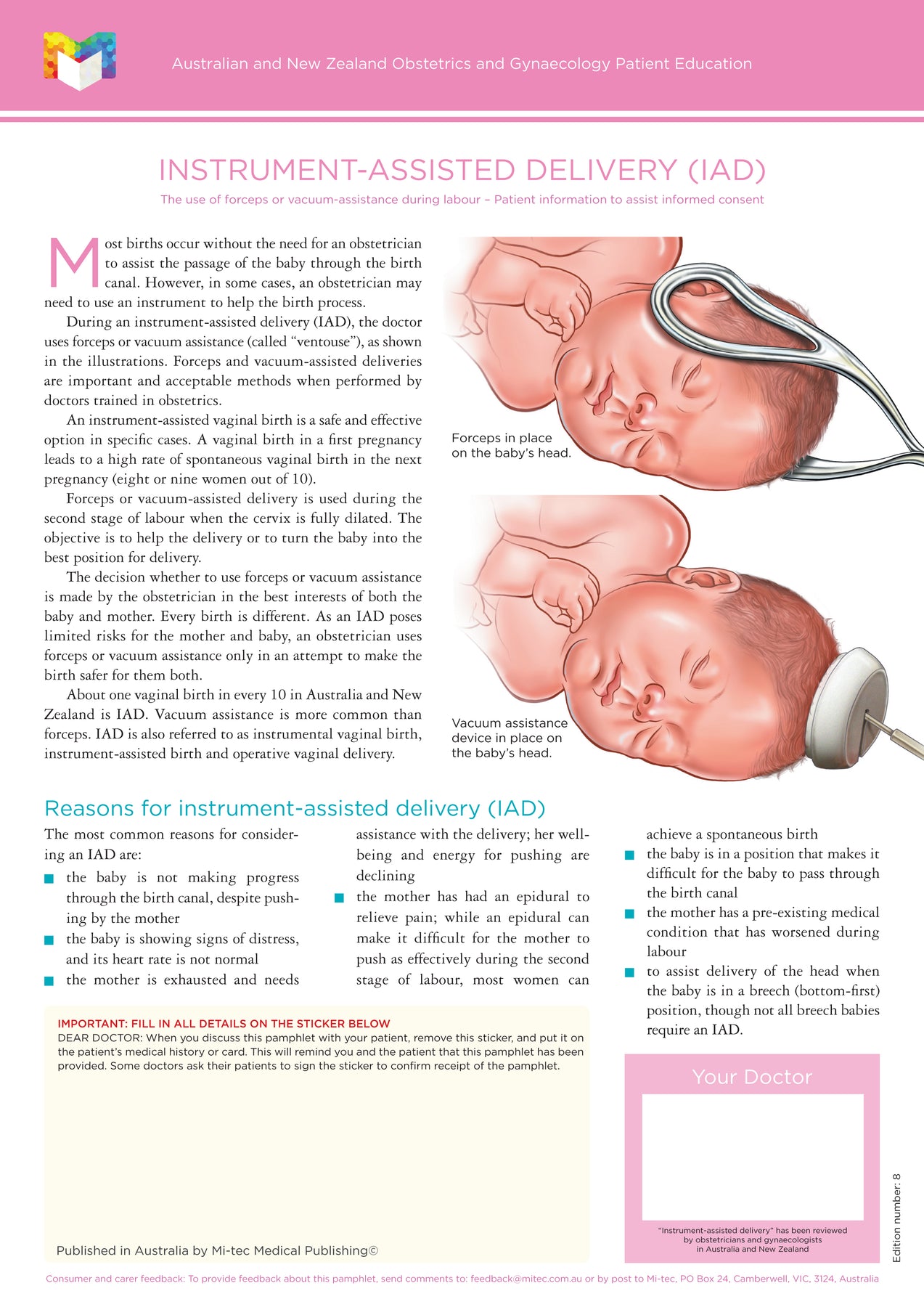 Obstetrics & Gynaecology Patient Education Pamphlets | Mi-tec Medical ...