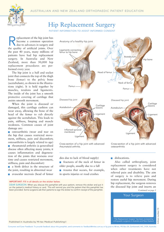 Hip Replacement Surgery