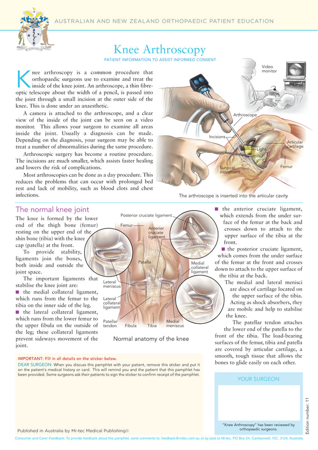 Knee Arthroscopy