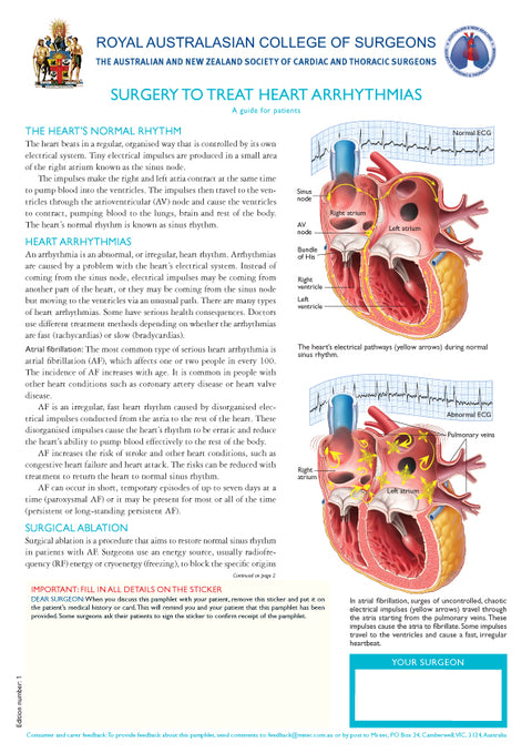 Surgery to treat heart arrhythmias