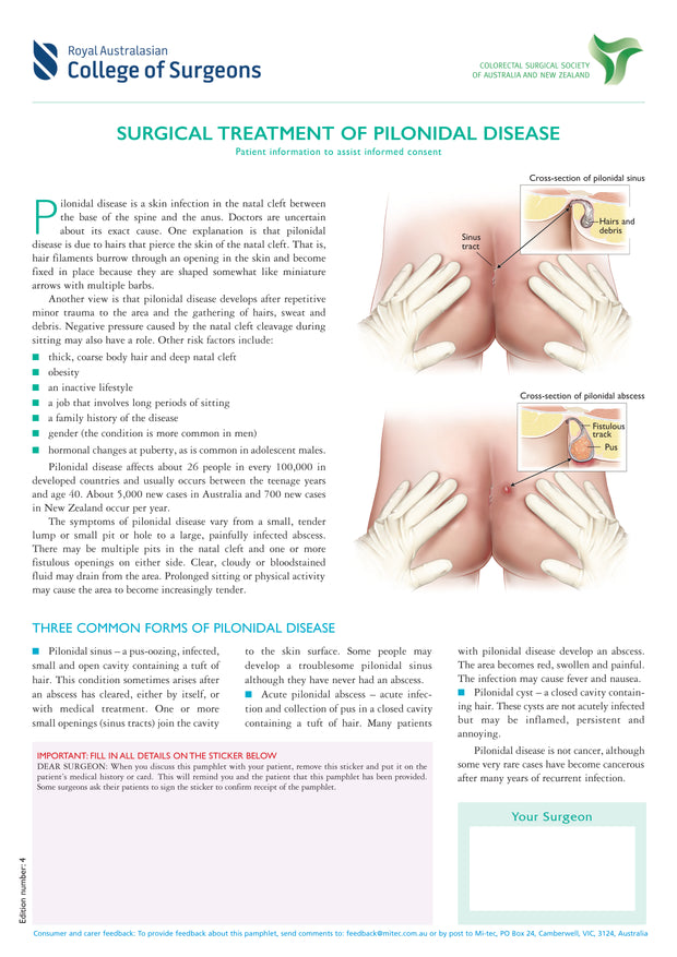 Surgical Treatment of Pilonidal Disease - A guide for patients