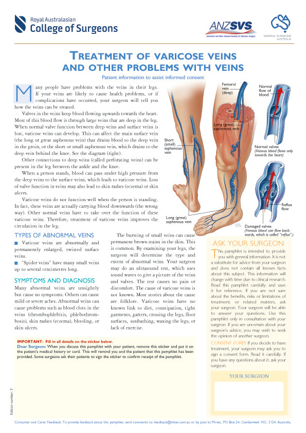 Treatment of Varicose Veins and Other Problems with Veins