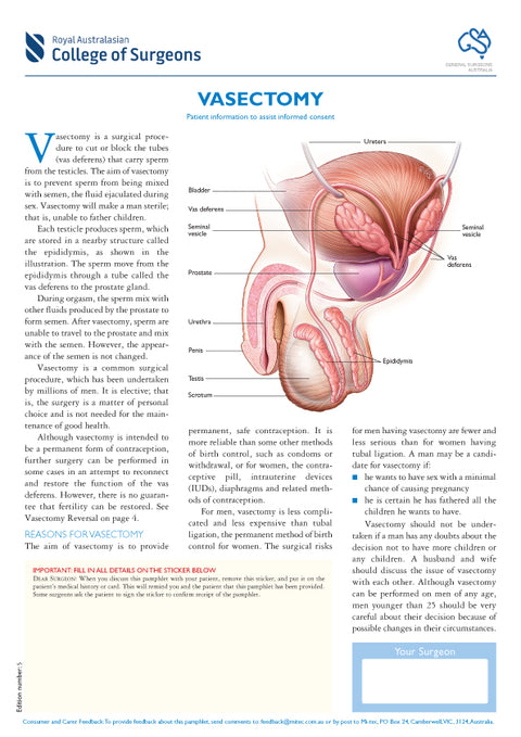 Vasectomy